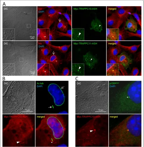 Figure 3 The TRAPPC10 and TRAPPC11 ASH domains target to the centrosome and affect microtubule organization