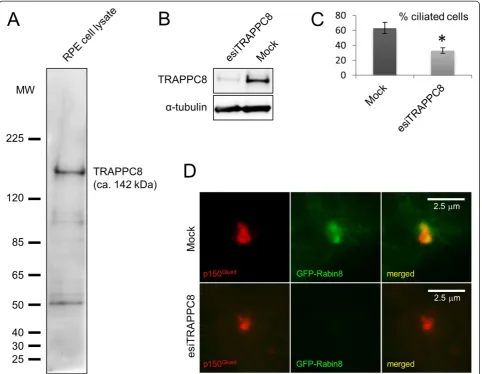 Figure 4 Western blot analysis and esiRNA-mediated depletion of TRAPPC8. (A)probed with rabbit polyclonal TRAPPC8 antibody