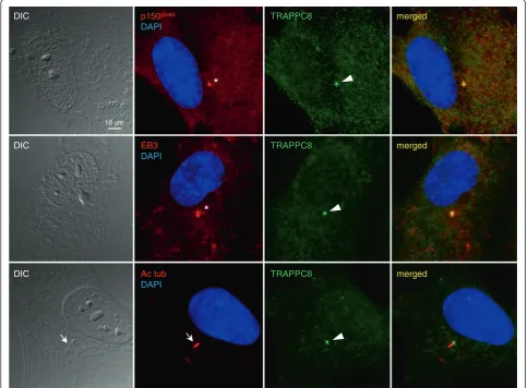 Figure 5 Endogenous TRAPPC8 localizes to the centrosome/basal body. RPE cells were serum-starved for 24 h, fixed with methanol (upper twopanels) or PFA (lower panel) and stained with rabbit polyclonal antibody against TRAPPC8 (green) and mouse monoclonal a