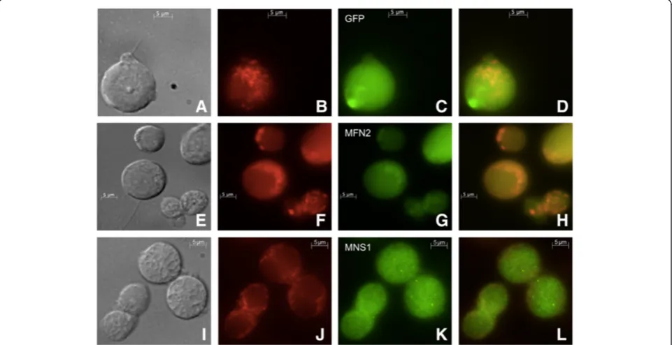Figure 9 Dual labeling immunofluorescence with anti-MFN2 and anti-MNS1 of cauda epididymal sperm to indicate co-localization.Nomarski differential interference contrast micrograph of cauda epididymal sperm (A)
