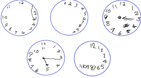 Fig. 1. Examples of clock drawings produced by people diagnosed with dementia. 