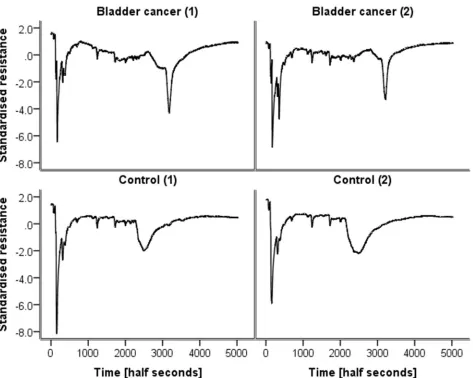 Figure 1.  cancer and two controls.Examples of chromatograms (standardised resistance vs