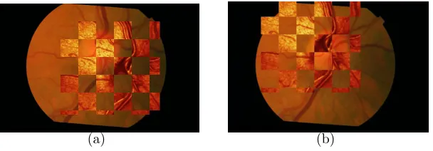 Figure 6: An example of di�cult registration. (a) Registration given by maximum MI.(b) Ground truth registration.