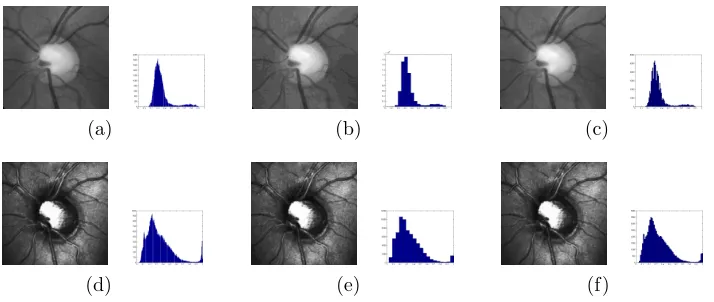 Figure 2: Fundus image and associated histogram (a) original, (b) computed using Sturges’Rule (19 bins), (c) computed using Scott’s Rule (84 bins)