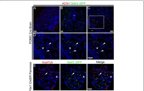 Figure 6 Cell type specific labeling of cilia using Cre mediated activation in the Cilia(red) and Sstr3::GFP (green) positive cilia are indicated by arrows, an example of a cilium labeled with ACIII but not Sstr3::GFP that is likely onnon-POMC neurons is i