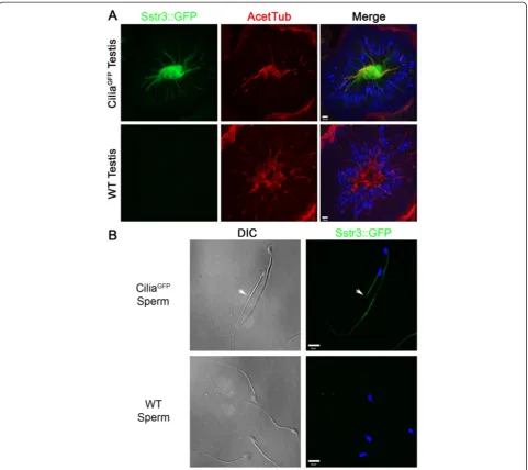 Figure 7 Sstr3::GFP localization in testes and sperm. (A) Sstr3::GFP localization in the mouse testes