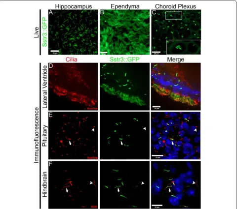 Figure 2 Analysis of Sstr3::GFP expression in the brain. (A-C) Images from ex vivo whole mount brains
