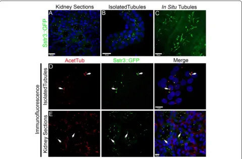 Figure 3 Sstr3::GFP labeled cilia in the kidney.sections and Sstr3:GFP localization. Acetylated Sstr3::GFP signal (green) in (A) fixed cryosections of the kidney, (B) isolated EIIa Cre;CiliaGFPtubules, (C) in situ in the proximal tubule of an anesthetized 