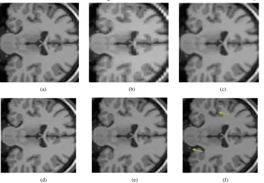 Figure 3. One slice from (a) The original volume,with GSM constraint algorithm,resolution slice; (c) The output volume for the SR with DBTV algorithm,sub-level GSM constraint algorithm, Original Slice; (b) One of the LR input volumes, Low  SR with DBTV; (d