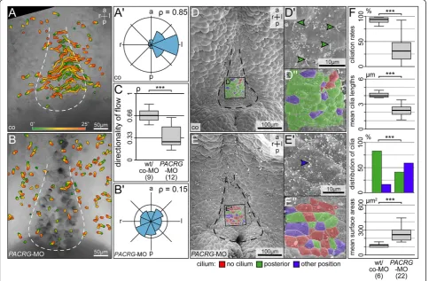 Figure 6 Absence of leftward flow and altered gastrocoel roof plate (GRP) morphology in PACRG morphants