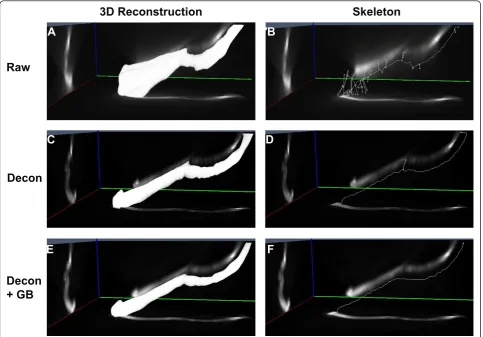 Figure 5 Skeletonization of microfibers in 3D. Orthogonal maximum projection images and associated skeletal representation of a microfiberin 3D