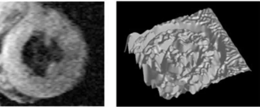 Figure 4: MR image of heart left ventricle and its potential energy function [V] 
