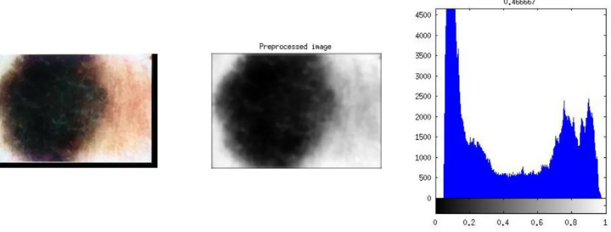 Figure 29: Traditional Otsu method. From left to right: original image, preprocessed luminance image, luminance  histogram with threshold value situated on top (0.467)