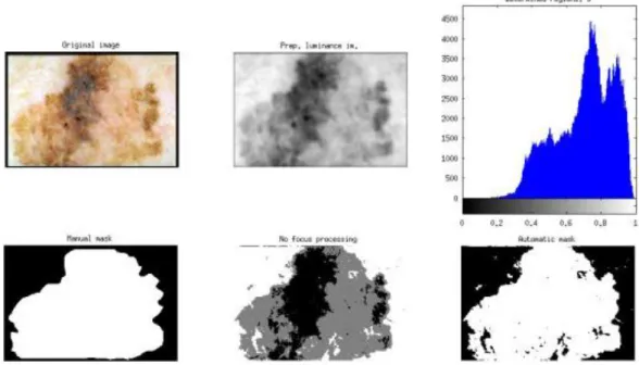 Figure 35: Multi-region k-means. On top: original image (left), preprocessed luminance image (center), luminance  histogram  with  number  of  determined  regions  above,  3  (right)