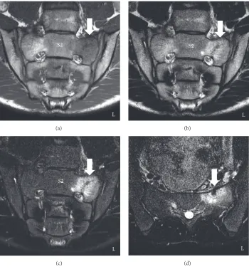 Figure 4: Magnetic resonance images of the sacrum one year after conservative treatment