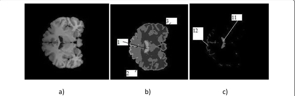 Figure 1 clustering using user-interaction (a) A real brain volume, (b) its 4 clusters and (c) two sub clusters of Cluster 3