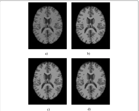 Figure 2 The segmentation results of applying EM1 and NWEM on a slice of image with 9% Rician noise