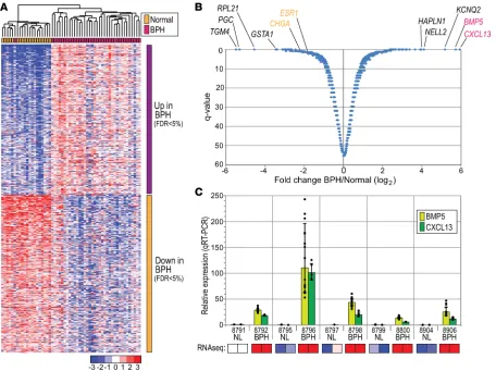 Figure 2. Genes differentially expressed in BPH versus normal prostate. (with topmost genes differentially expressed in BPH