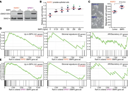 Figure 3. BMP5 addition to cultured prostate cells supports role in BPH disease process