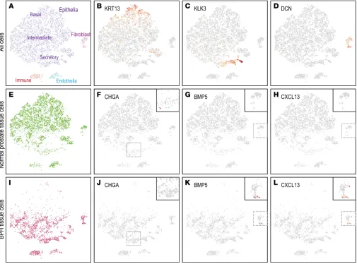 Figure 5. scRNA-Seq reveals altered cell subsets in BPH. (tissue cell subset, illustrating expression of (A) Two-dimensional projection (t-SNE plot) of single-cell transcriptomes stratifies prostate tissue cells (dots) into distinct clusters, identifiable 