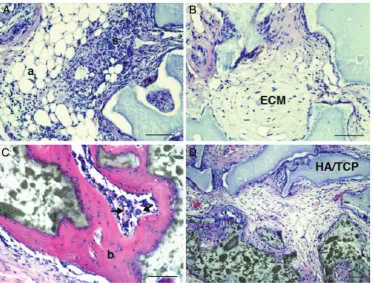 Figure 4Lung mesenchymal stem cells (MSC) are donor derived and tissue resident. Cultured MSC isolated from central(A and C) and peripheral transbronchial (B and D) biopsies of seven sex-mismatched lung-transplanted patients were harvestedand analysed by f