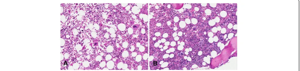 Figure 1 H&E of bone marrow in ETnot increased, the megakaryocytes were mainly giant with stag-horn like nuclei and showed low tendency to aggregate