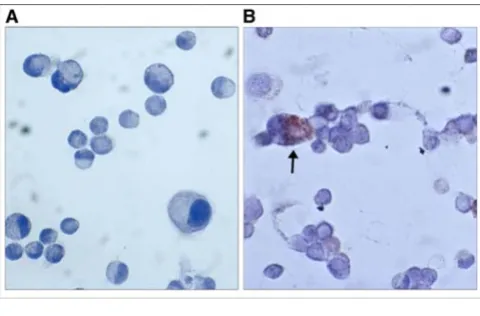 Figure 3lium cells, A549Mast cell HMC-1 migration towards the lung type II epithe-Mast cell HMC-1 migration towards the lung type II epithe-lium cells, A549