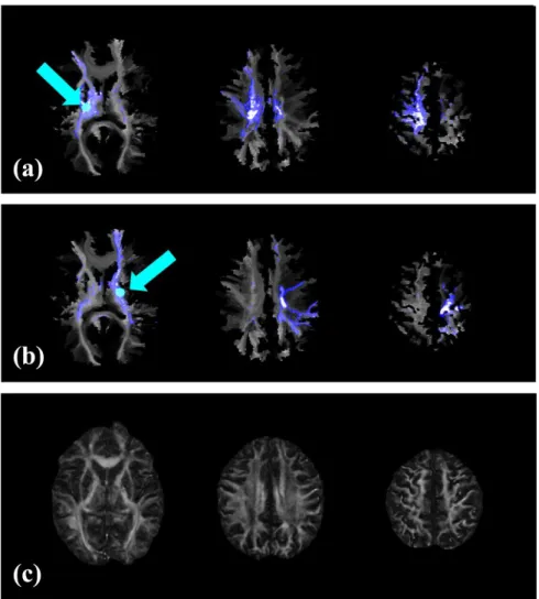 Figure 2-5: Changes in VISC distant from a lesion 
