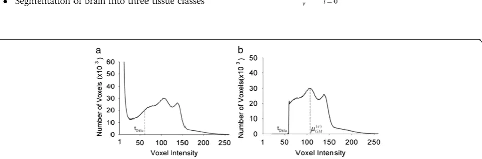 Figure 2 Histogram of the image p(i). (a) Histogram of the real data p(i) The Ostu threshold, which segments the background fromforeground the voxels, is marked
