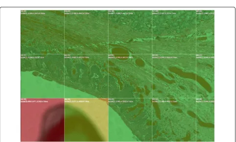 Figure 4 NDPI sharpness results. Hamamatsu NDPI 18.7 billion pixel Whole Slide Image and its sharpness map, analyzed at a 3-billion-pixel-per-minute rate