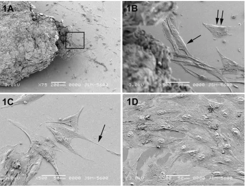 Figure 1Scanning electron micrographs of primary breast cancer cellsScanning electron micrographs of primary breast cancer cells