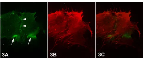 Figure 2ture of normal breast tissueEpifluorescent micrographs of epithelial cells of primary cul-Epifluorescent micrographs of epithelial cells of primary cul-ture of normal breast tissue