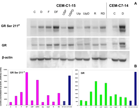 Figure 7Evaluation of GR protein and phosphorylation state in CEM-C1-15 cells rendered sensitive to Dex by several treatmentstreatmentsEvaluation of GR protein and phosphorylation state in CEM-C1-15 cells rendered sensitive to Dex by several 