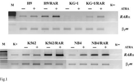 Table 1: Specific gene primers used for RT-PCR