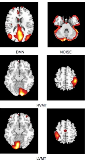 Figure 5.1: Experiment 2- Investigated brain activations - Spatial maps of ICsconsidered in the simulation obtained from Group ICA 20 ICs