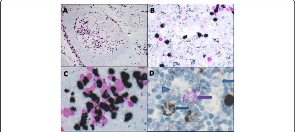 Figure 2 2-Color RNA Detection Methodology. A cocktail of antisense hapten-labeled riboprobes, targeting the constant region of eitherKAPPA or LAMBDA mRNA, was hybridized to de-paraffinized protease treated tissue samples
