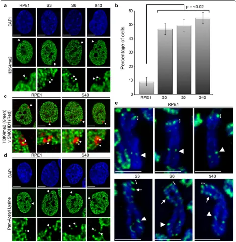Fig. 3 H3K4me2 gain at Xp21 on Xi in SETDB1 mutants. a Indirect immunofluorescence showing the distribution of H3K4me2 (Green) in representative RPE1 and SETDB KO nuclei