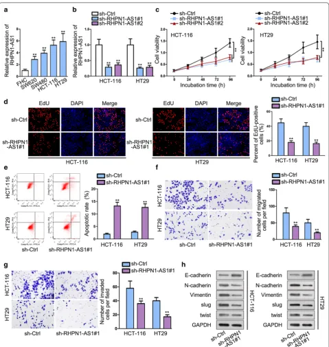 Fig. 1 RHPN1-AS1 is aberrantly up-regulated in CRC and knockdown of RHPN1-AS1 suppresses the malignant behaviors of CRC