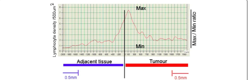 Figure 4 Distribution of CD3+ density according to the LQLpattern.