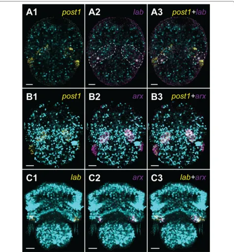 Fig. 6 Expression of the chaetae-related genes in the early developmental stages of Terebratalia transversa combined with DAPI staining of cell nuclei (cyan)