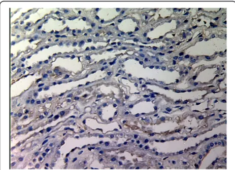 Figure 1 MMP-2 expression in renal tissue with differentdegree of inflammatory infiltration(EnVision assay; originalmagnification × 200)