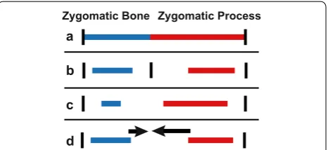 Fig. 8 Potential developmental mechanisms underlying zygomatic arch variation. Schematic models of developmental mechanisms by which an a adult phenotype of relative skeletal contribution to the zygomatic arch might occur
