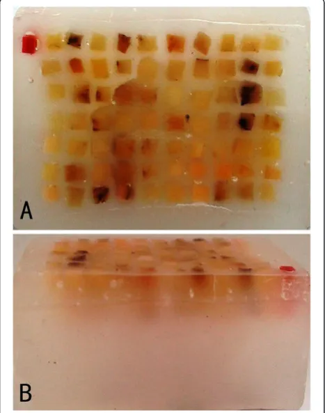 Figure 6 Sequence of KIT gene at codons 557 and 558,