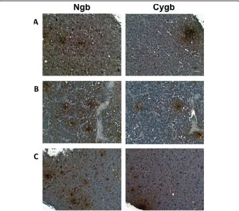 Figure 6 Expression of Cygb and Ngb in human primary brain tumors. Tissue microarrays containing cores obtained from various humanbrain tumors were stained with to antibodies to Ngb or Cygb