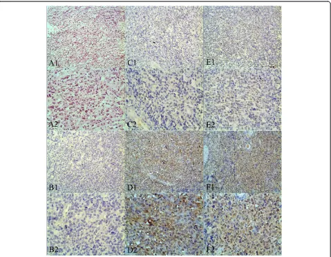 Figure 1 Immunohistochemical staining of LMP1 and LMP2A in clinical tissue samples of ENKTL