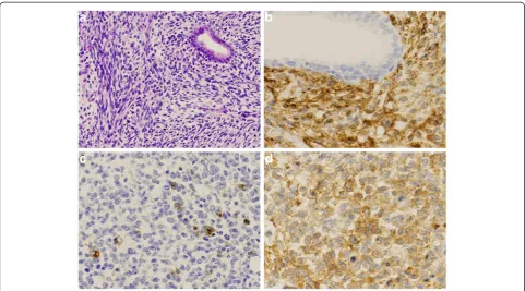 Figure 3 Microscopic findings. a)The tumor was made up of sarcomatoid oval to spindle cells