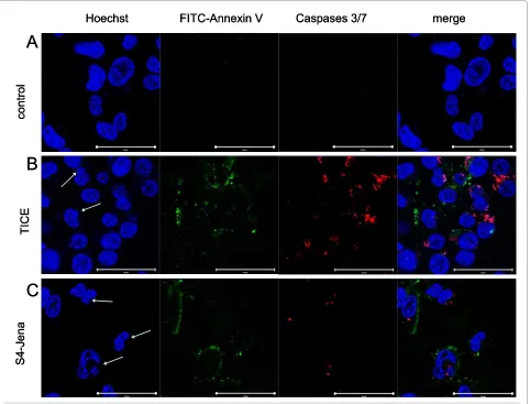 Figure 4 Apoptotic cell death in T24 cells infected with BCG. T24 cells were infected with BCG TICE (B) or S4-Jena (C) strain compared to uninfect-ed control cells (A) for 24 h
