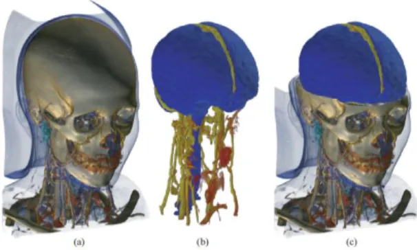 Figure 3: Volume render 