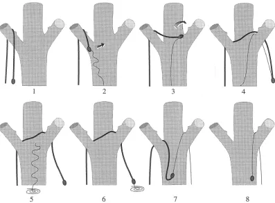 FIGURE 1. or RHS the thick hand should (1). A ground based method for repositioning lines in trees