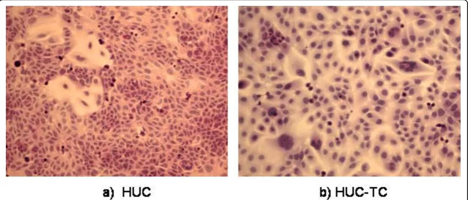 Figure 2 Growth rate of HUC-TC cells was significantly higher than HUC. (Error bars = SEM, average of 24 SD’s from n = 3 experiments).Significance level = p < 0.05) for days 1-5 using two-tailed paired t-test.